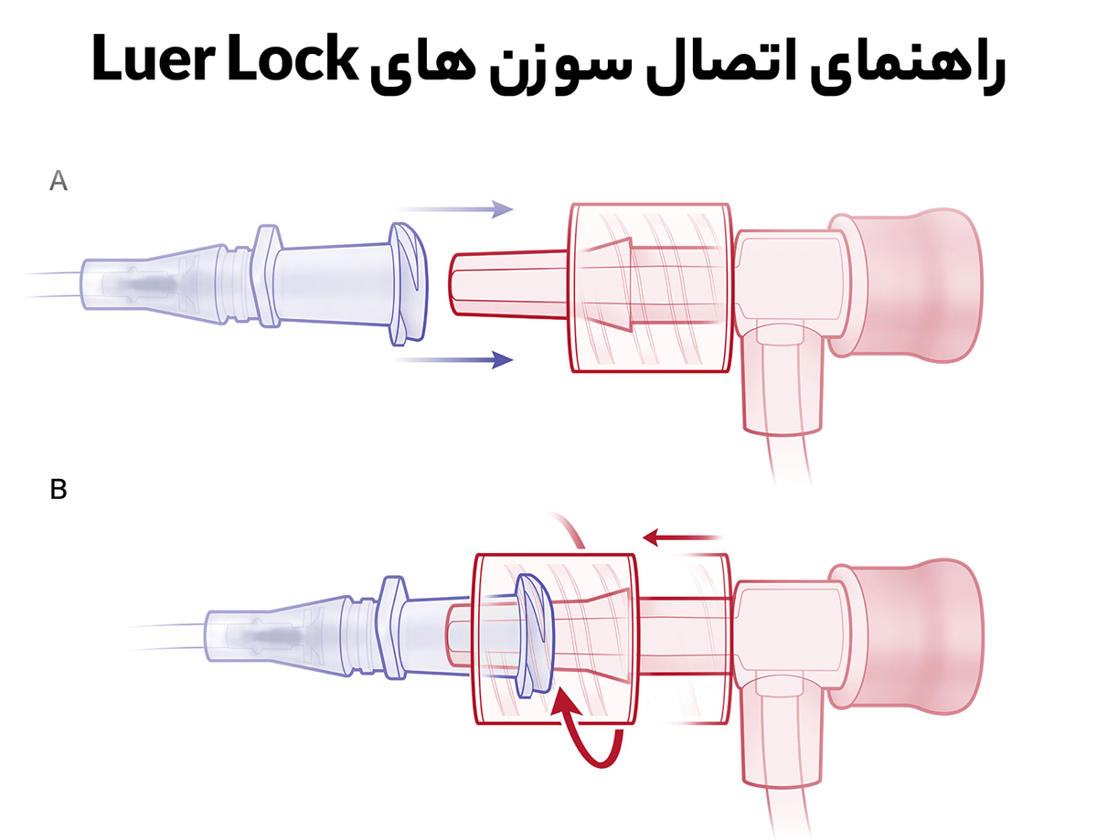 راهنمای اتصال سوزن تزریق لوئر لاک