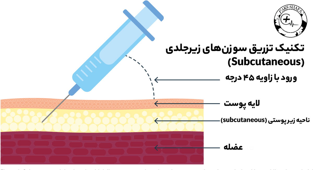 تکنیک سوزن تزریقات زیرجلدی (Subcutaneous)