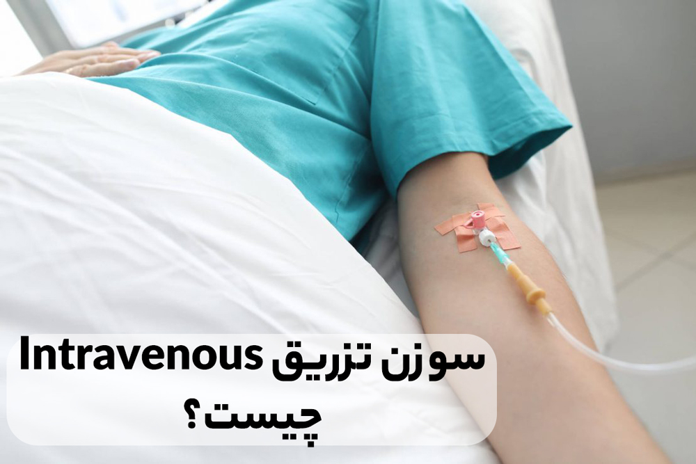 سوزن داخل‌وریدی (Intravenous)