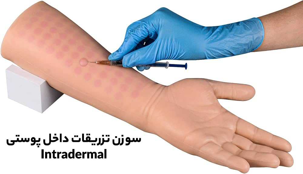 Intradermal سوزن تزریقات